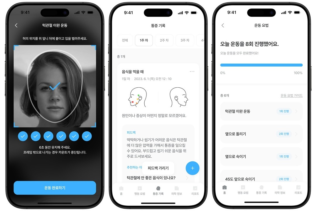 턱관절장애 디지털 치료 앱 사용모습
